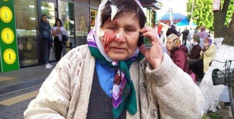 У Костополі власниця салону розбила бабусі голову
